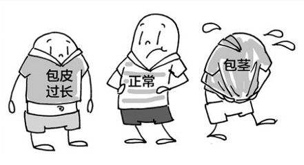 包皮过长不做手术如何治疗?