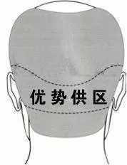 【健康】想做植发却不了解?为你全方位剖析植发,让你不再担忧!