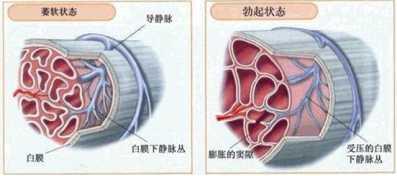 【科普】对阳痿早泄的各种偏方说“NO”,看规范治疗方法和效果分析
