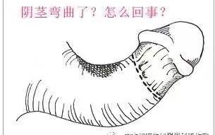 “枪”歪了,一定要“修”吗?