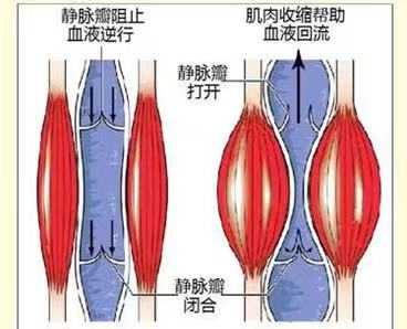 管好这三件生活日常,远离精索静脉曲张!